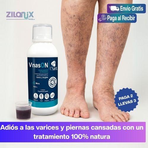 venas 